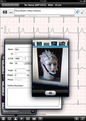 Wifi Home ECG Machine Multichannel iPhone ECG Device For IOS System